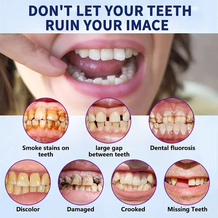 Orthorun | SmileFitPro-New Generation Flexible Full Denture Solution