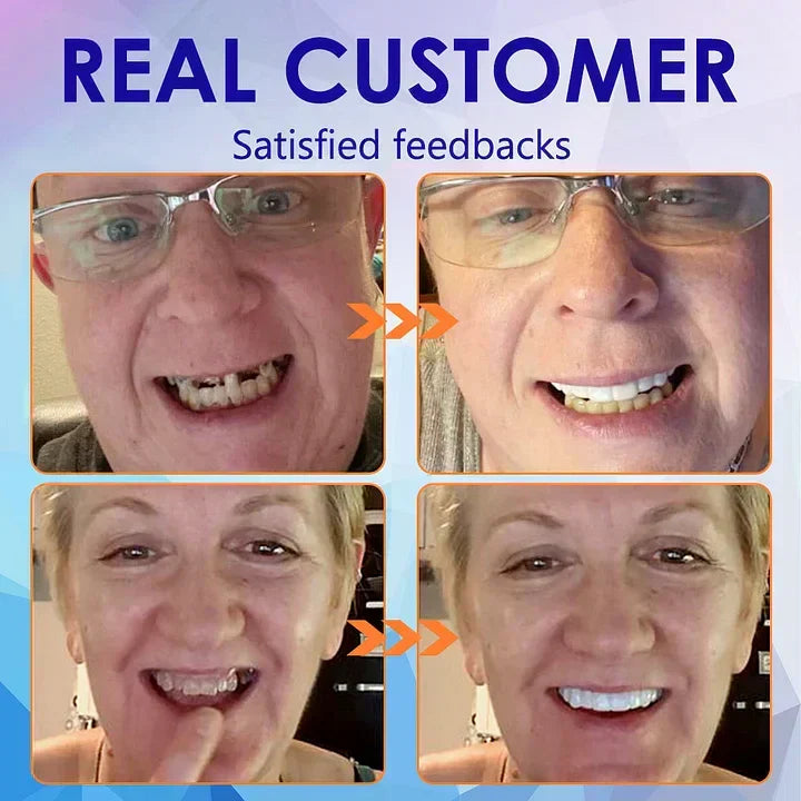 Orthorun | SmileFitPro-New Generation Flexible Full Denture Solution