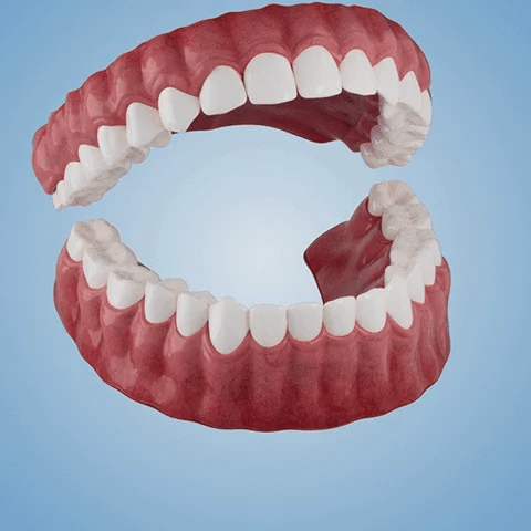 Orthorun | SmileFitPro-New Generation Flexible Full Denture Solution