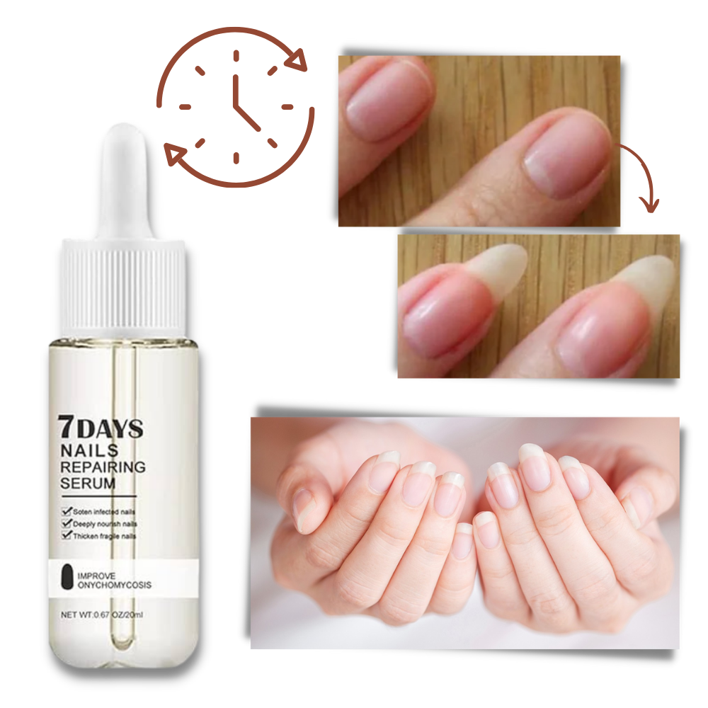 7 Days Nail Repair Essence