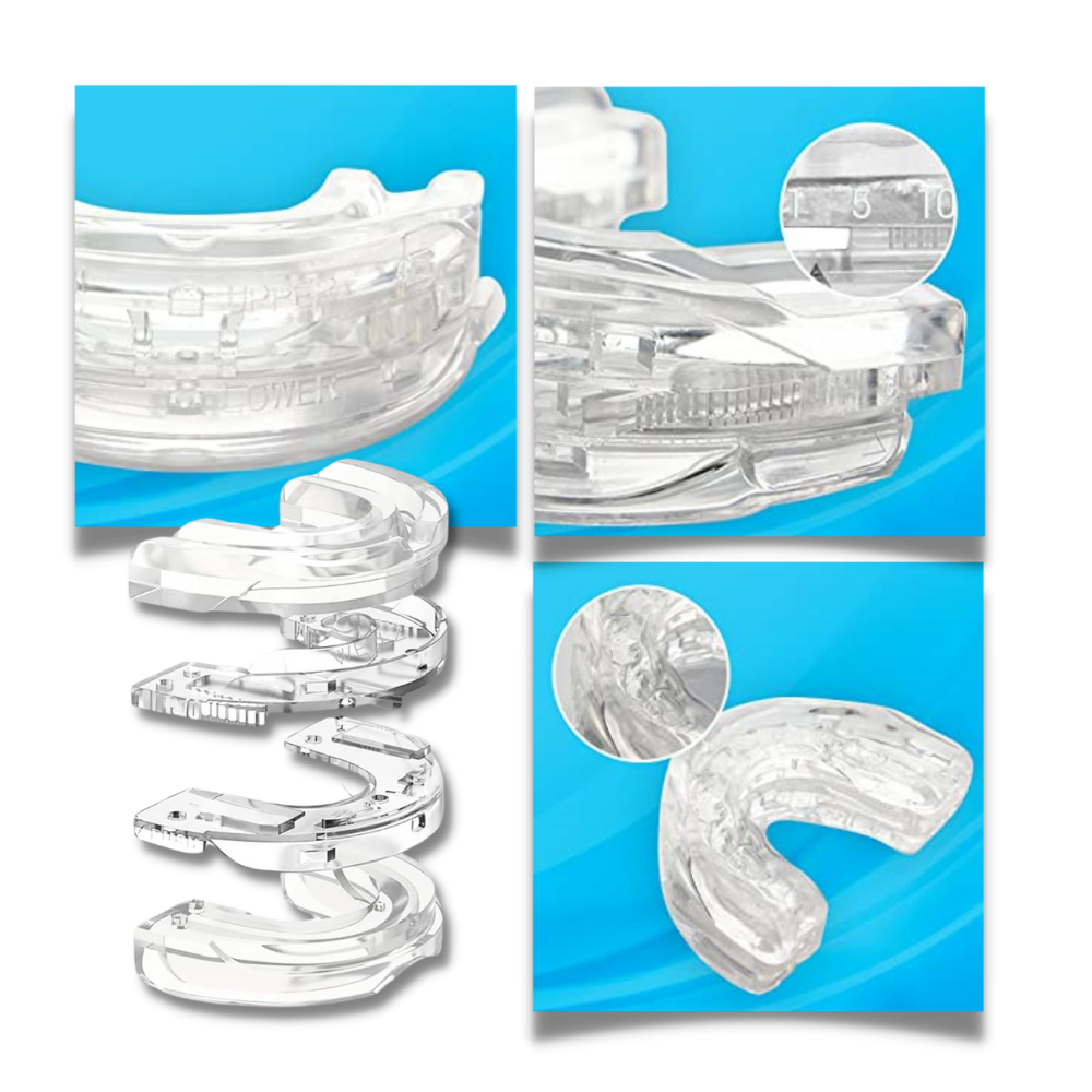 Advanced anti-snoring device