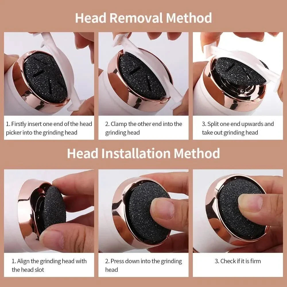 KallusCare – Rechargeable Callus Remover for Smooth & Silky Feet